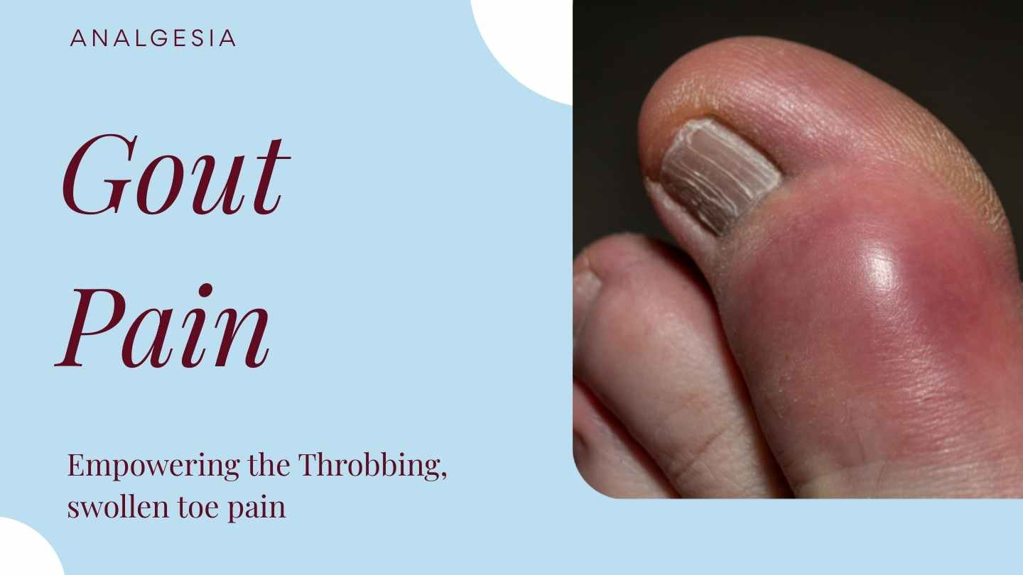Gout Pain Relief — Causes & How to Treat Gout